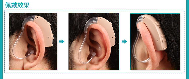 西门子助听器配戴效果图|耳背式助听器效果图